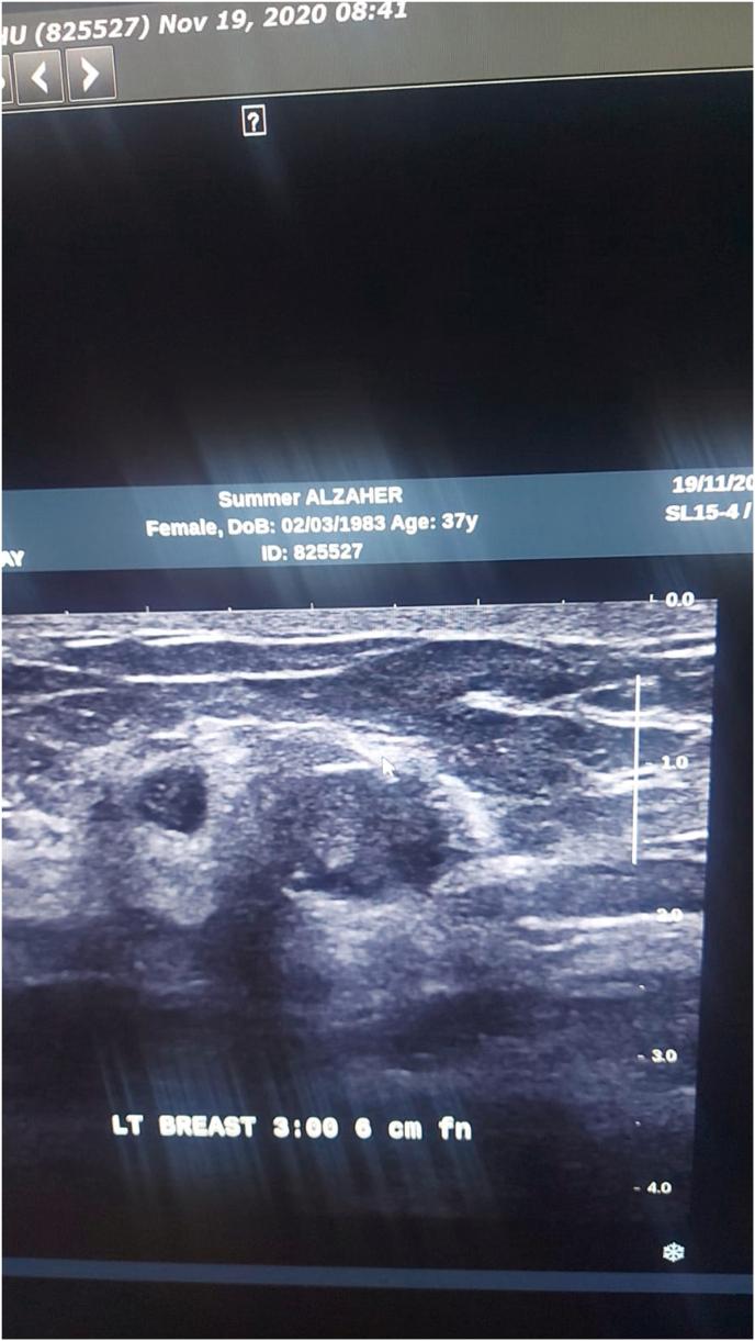 https://cdn.ncbi.nlm.nih.gov/pmc/blobs/2e8e/8519765/be120e2f4ef9/gr8.jpg