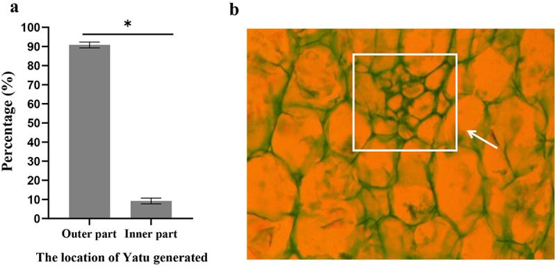 https://cdn.ncbi.nlm.nih.gov/pmc/blobs/2e91/9348129/e32e73a0ce42/KPSB_A_2106075_F0003_OC.jpg