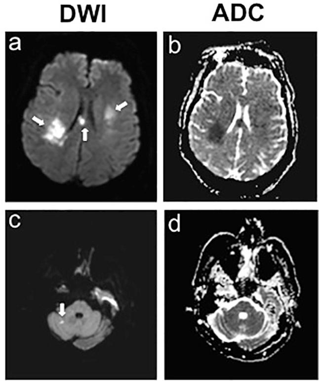 https://cdn.ncbi.nlm.nih.gov/pmc/blobs/2e94/5534754/e2c9b54d5e50/bcr-2016-218105f04.jpg