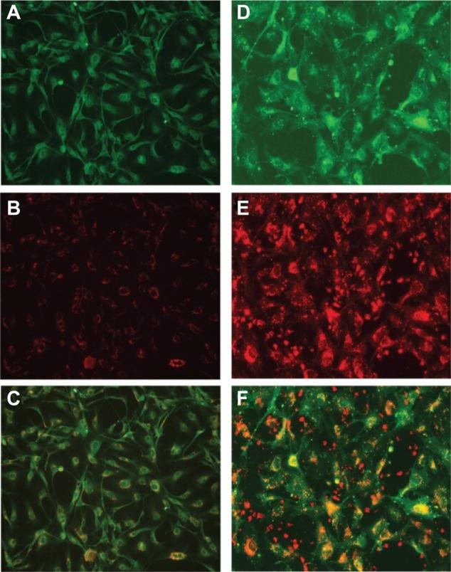 https://cdn.ncbi.nlm.nih.gov/pmc/blobs/2e9f/3984056/3792d852ac38/ijn-9-1757Fig5.jpg