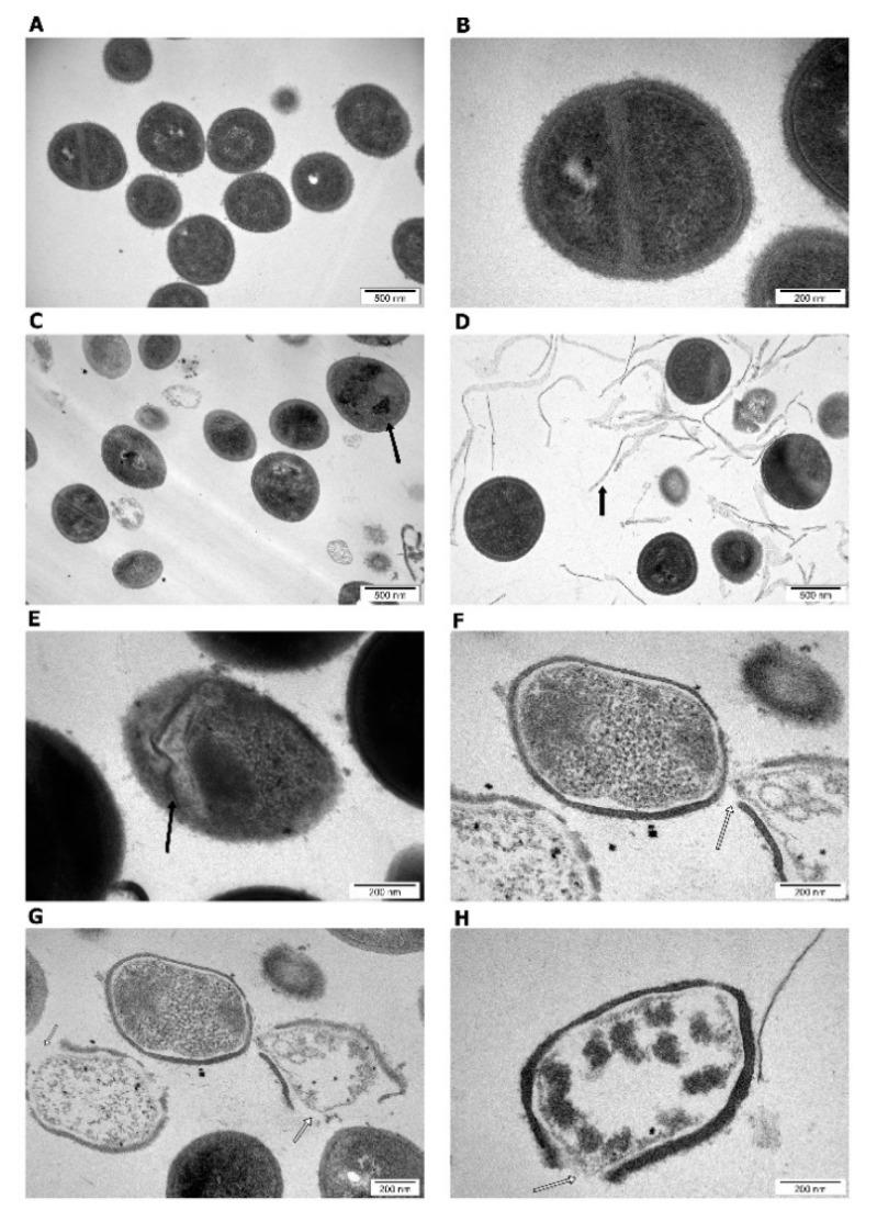 https://cdn.ncbi.nlm.nih.gov/pmc/blobs/2ea0/8348526/a5bc8147452e/materials-14-04250-g010.jpg