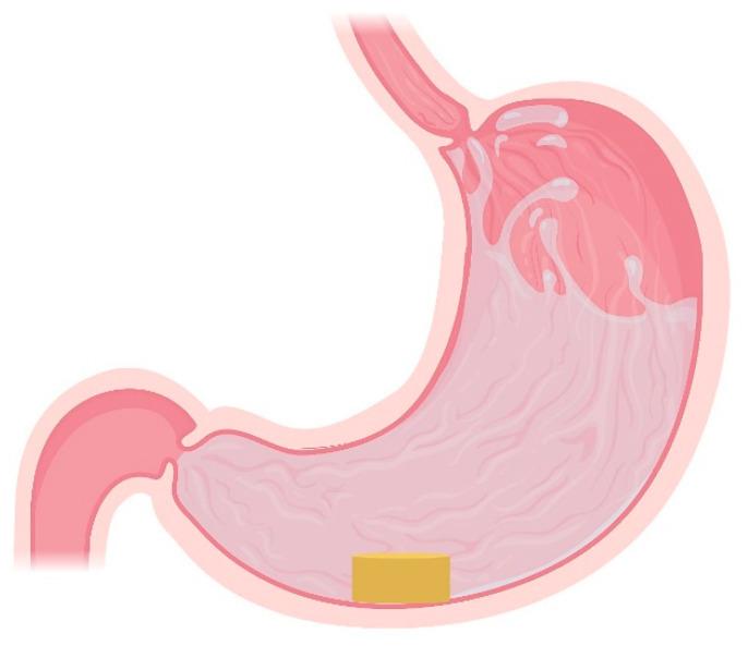 https://cdn.ncbi.nlm.nih.gov/pmc/blobs/2ea3/8539558/24f2b08e7687/pharmaceutics-13-01591-g005.jpg
