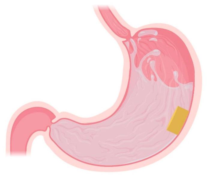 https://cdn.ncbi.nlm.nih.gov/pmc/blobs/2ea3/8539558/3075d5120a68/pharmaceutics-13-01591-g006.jpg