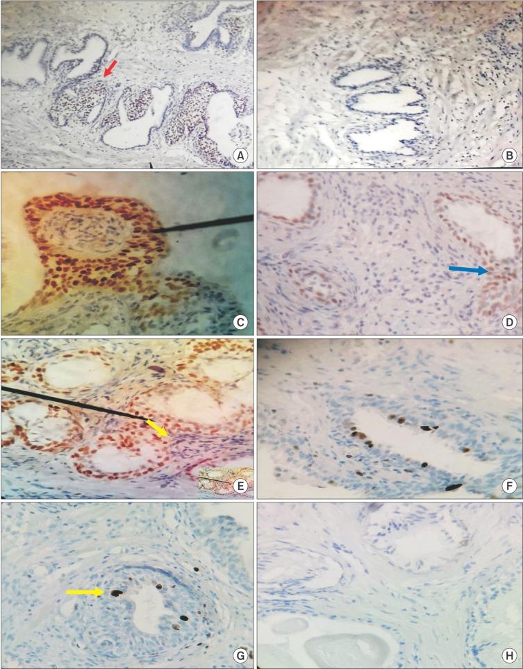 https://cdn.ncbi.nlm.nih.gov/pmc/blobs/2ea4/5330371/4a097f343285/icu-58-117-g002.jpg