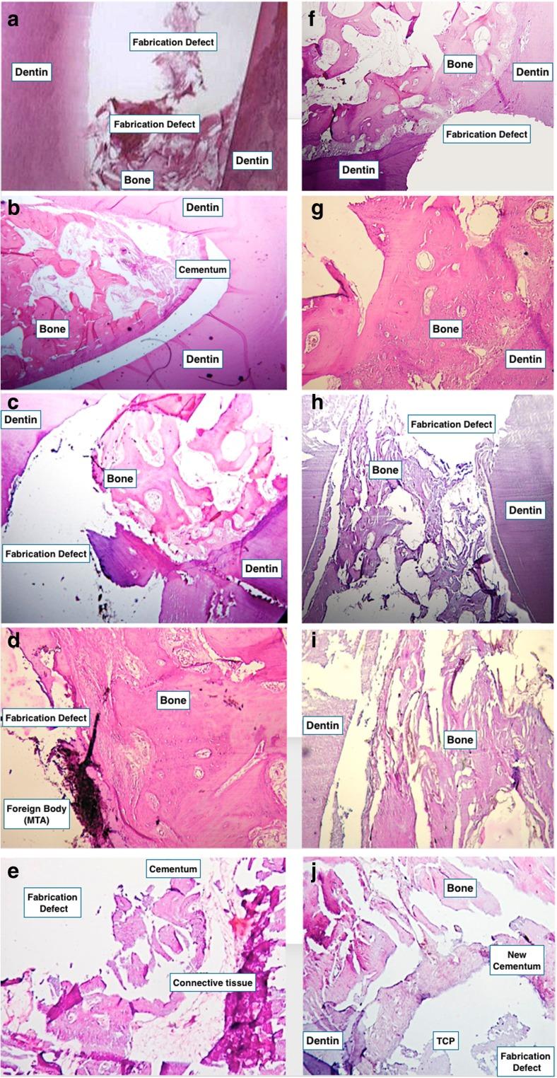 https://cdn.ncbi.nlm.nih.gov/pmc/blobs/2ea9/5442265/c55cae04b387/784_2016_1967_Fig3_HTML.jpg
