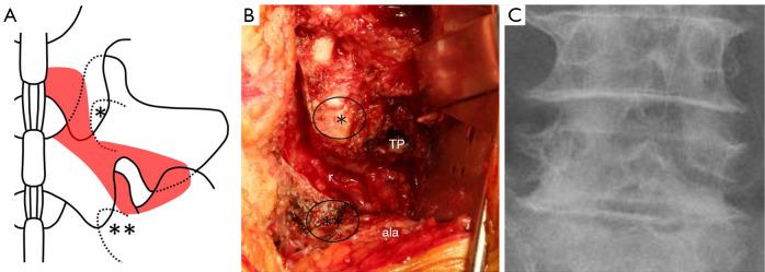 https://cdn.ncbi.nlm.nih.gov/pmc/blobs/2eaa/10570647/48895c885ee3/jss-09-03-278-f1.jpg