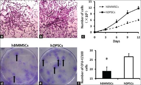 https://cdn.ncbi.nlm.nih.gov/pmc/blobs/2eaa/4144126/775799d8cd5a/EJD-8-307-g002.jpg