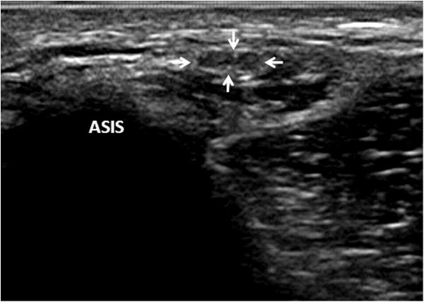 https://cdn.ncbi.nlm.nih.gov/pmc/blobs/2eb1/3552899/a51cabf6273e/1471-2474-13-227-5.jpg