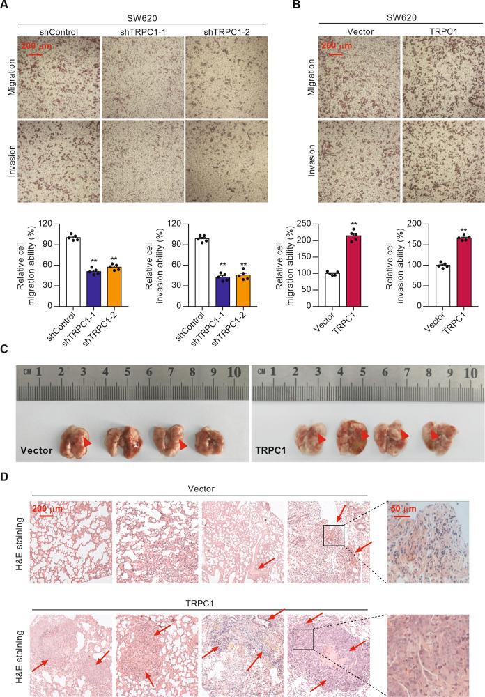 https://cdn.ncbi.nlm.nih.gov/pmc/blobs/2eb1/8511127/986d656684f3/41389_2021_356_Fig4_HTML.jpg