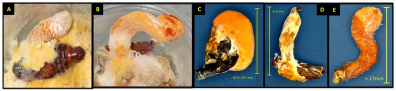 https://cdn.ncbi.nlm.nih.gov/pmc/blobs/2ebb/10299621/ed44f0728b2b/jof-09-00614-g006.jpg