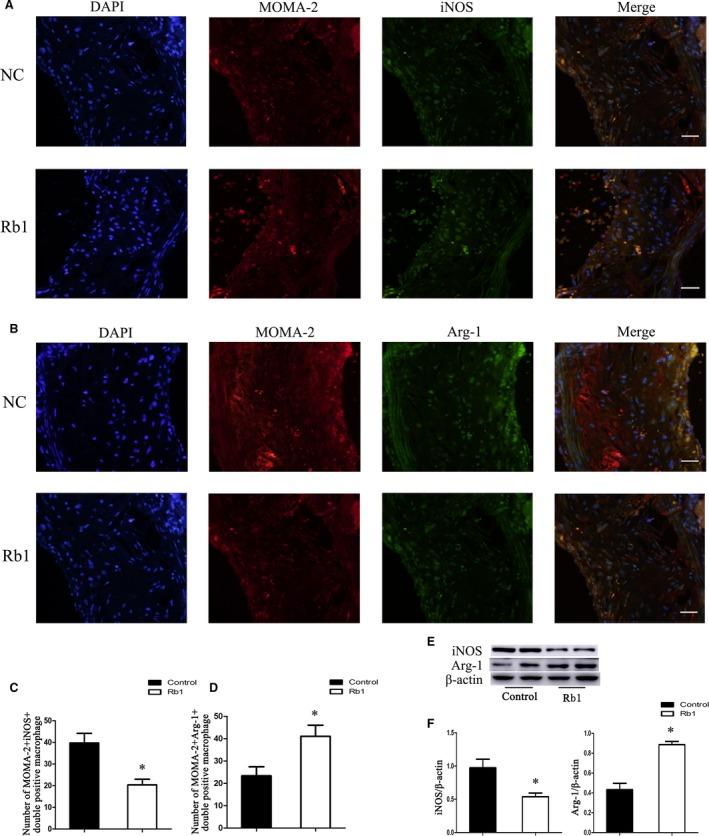 https://cdn.ncbi.nlm.nih.gov/pmc/blobs/2ebc/5742675/b3adf26e140c/JCMM-22-409-g005.jpg