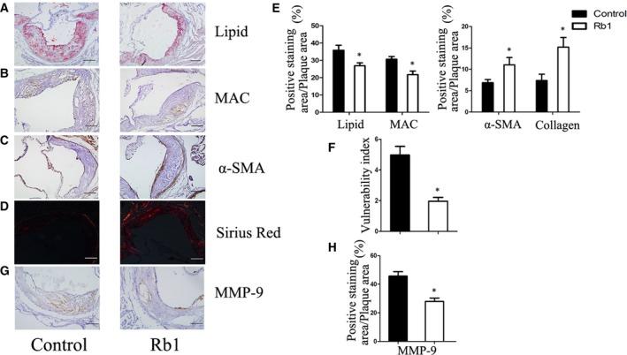 https://cdn.ncbi.nlm.nih.gov/pmc/blobs/2ebc/5742675/e95633c2eb0a/JCMM-22-409-g004.jpg