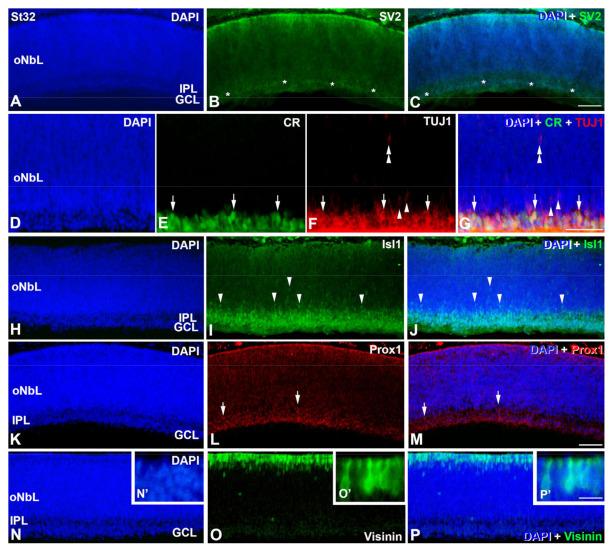 https://cdn.ncbi.nlm.nih.gov/pmc/blobs/2ec8/10093483/2b406e555cd3/cells-12-00989-g004.jpg
