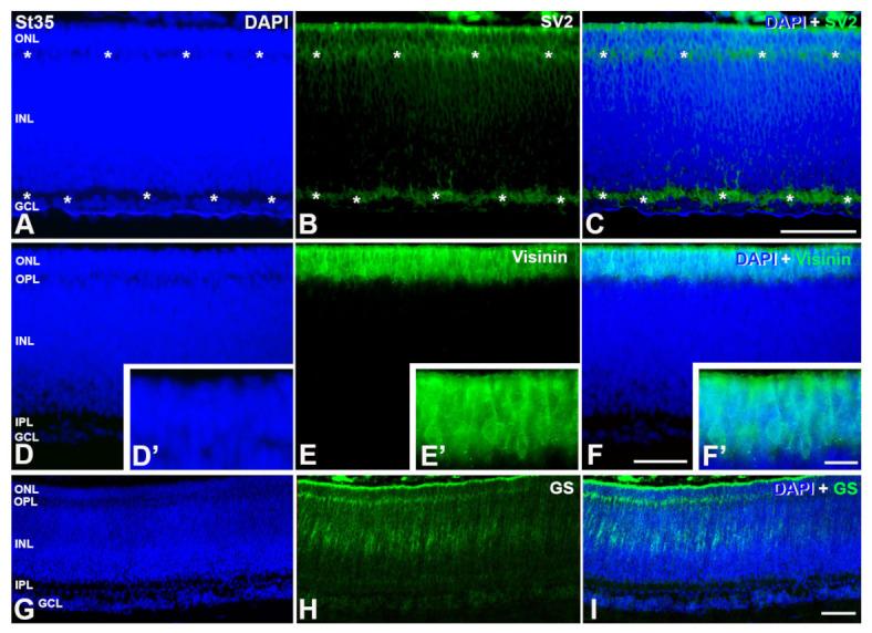 https://cdn.ncbi.nlm.nih.gov/pmc/blobs/2ec8/10093483/4dba00d44f73/cells-12-00989-g006.jpg