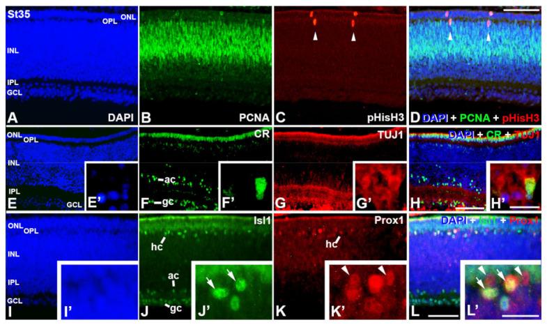 https://cdn.ncbi.nlm.nih.gov/pmc/blobs/2ec8/10093483/5d6836223f4d/cells-12-00989-g005.jpg