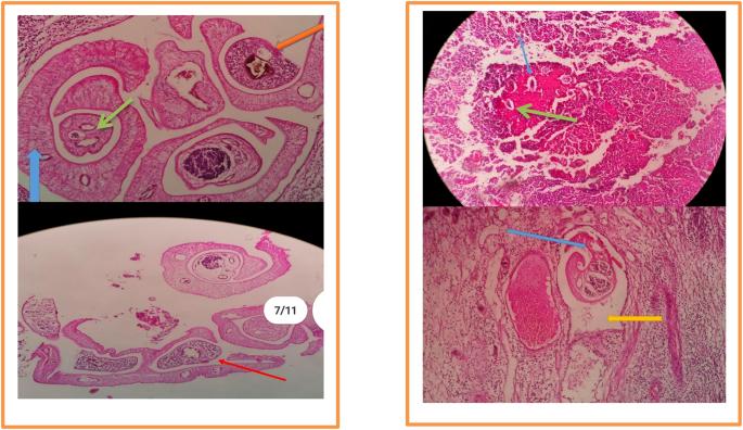 https://cdn.ncbi.nlm.nih.gov/pmc/blobs/2ec9/12305331/99ee045619d8/gr3.jpg