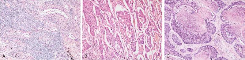 https://cdn.ncbi.nlm.nih.gov/pmc/blobs/2ecd/6426613/155756559ca6/medi-98-e14876-g001.jpg