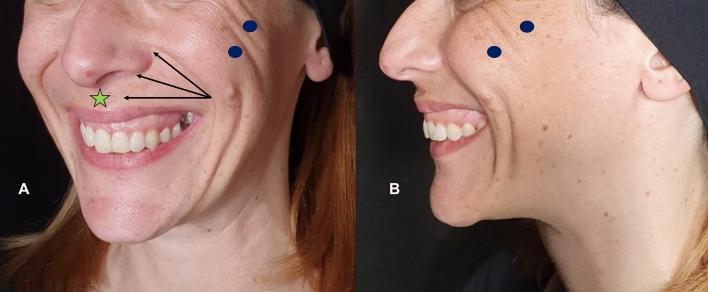 https://cdn.ncbi.nlm.nih.gov/pmc/blobs/2ed3/8481201/9e949b6528e2/266_2021_2169_Fig8_HTML.jpg