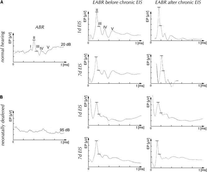 https://cdn.ncbi.nlm.nih.gov/pmc/blobs/2ed8/5827675/64ec4d648566/fncel-12-00043-g001.jpg