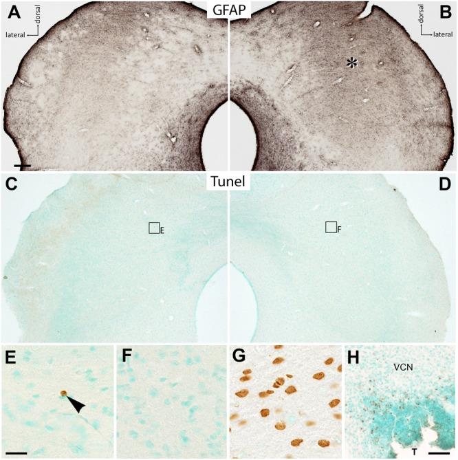 https://cdn.ncbi.nlm.nih.gov/pmc/blobs/2ed8/5827675/aec8526d6001/fncel-12-00043-g006.jpg