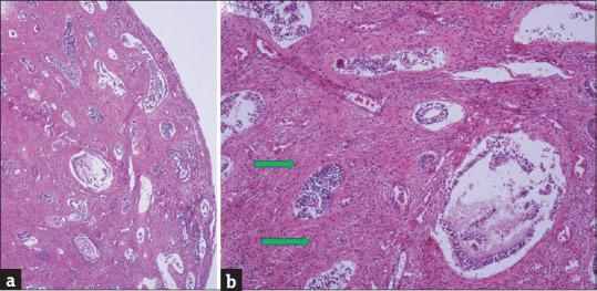 https://cdn.ncbi.nlm.nih.gov/pmc/blobs/2eda/8849152/2ce885015bc0/JMH-12-310-g007.jpg