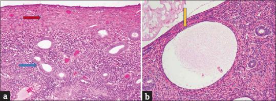 https://cdn.ncbi.nlm.nih.gov/pmc/blobs/2eda/8849152/667cdaa6e530/JMH-12-310-g005.jpg
