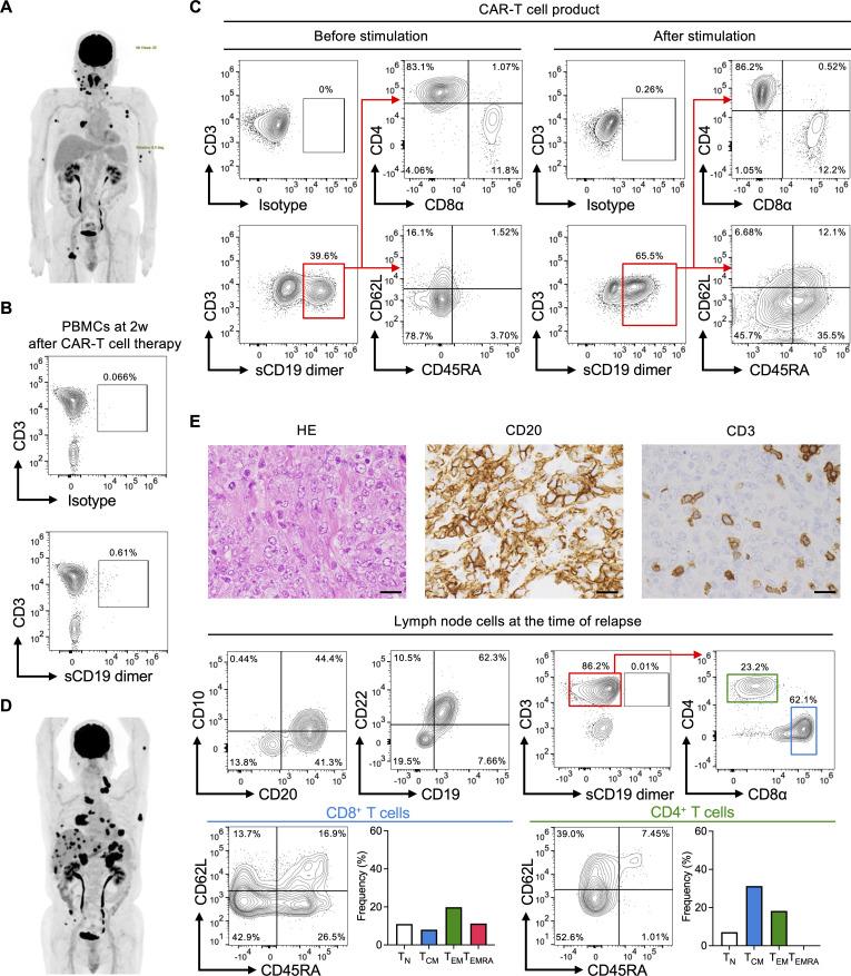 https://cdn.ncbi.nlm.nih.gov/pmc/blobs/2ee6/12198839/2acf34365789/jitc-13-6-g001.jpg