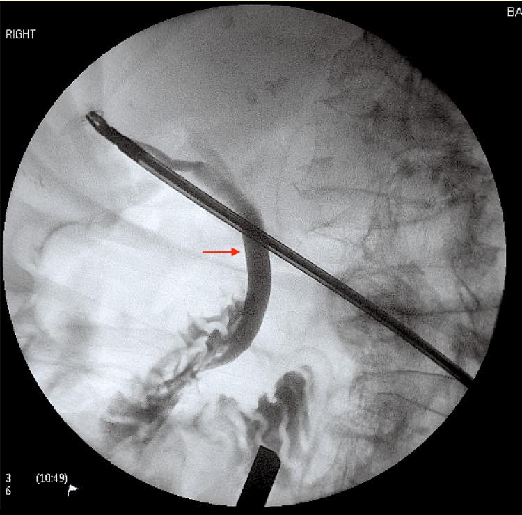 https://cdn.ncbi.nlm.nih.gov/pmc/blobs/2ee7/10103832/2434dcf80e79/cureus-0015-00000036256-i03.jpg