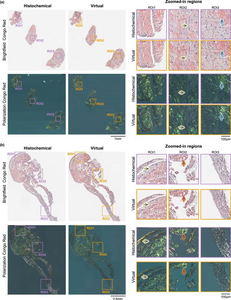 https://cdn.ncbi.nlm.nih.gov/pmc/blobs/2eea/11393327/812c303118fa/41467_2024_52263_Fig2_HTML.jpg