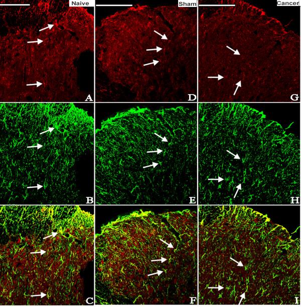https://cdn.ncbi.nlm.nih.gov/pmc/blobs/2eec/3558391/078fb02d6d4c/1742-2094-9-278-3.jpg