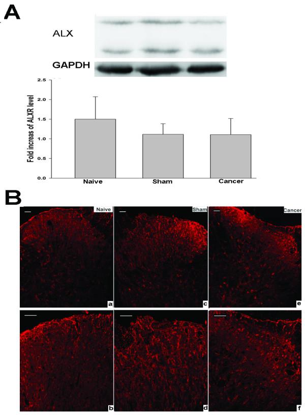 https://cdn.ncbi.nlm.nih.gov/pmc/blobs/2eec/3558391/a939ed29d559/1742-2094-9-278-2.jpg