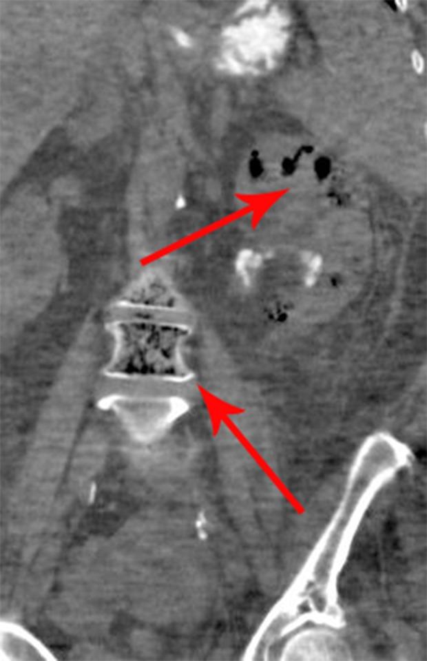 https://cdn.ncbi.nlm.nih.gov/pmc/blobs/2ef0/6913288/290939ae9f1f/amjcaserep-20-1793-g002.jpg