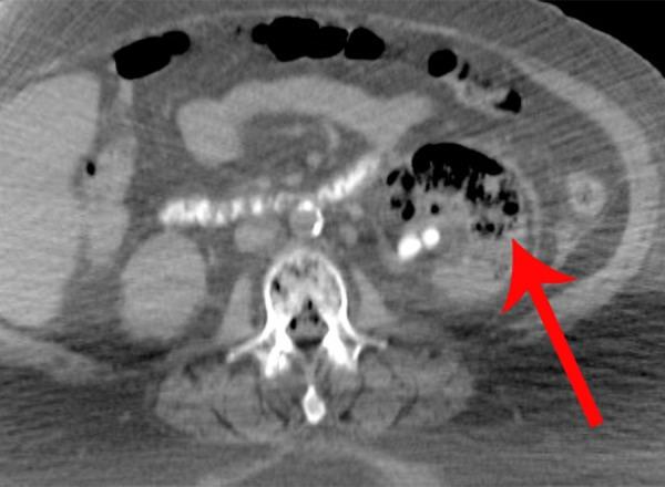 https://cdn.ncbi.nlm.nih.gov/pmc/blobs/2ef0/6913288/366f66908e14/amjcaserep-20-1793-g001.jpg