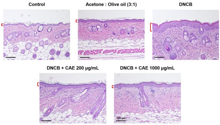 https://cdn.ncbi.nlm.nih.gov/pmc/blobs/2ef6/10418848/0db0442b712b/ijms-24-12367-g015.jpg