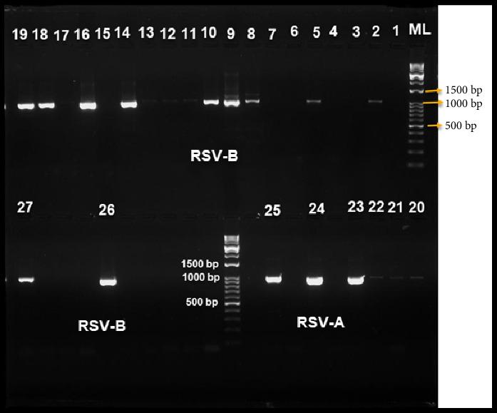 https://cdn.ncbi.nlm.nih.gov/pmc/blobs/2efd/11971507/b633497970c2/AV2025-8864776.002.jpg