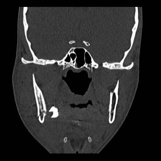 https://cdn.ncbi.nlm.nih.gov/pmc/blobs/2f00/7752351/cedcb9c64cef/CCR3-8-3479-g004.jpg
