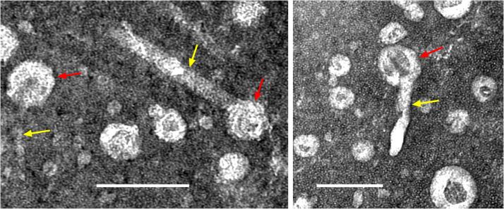 https://cdn.ncbi.nlm.nih.gov/pmc/blobs/2f07/11670727/62105c1f5945/gr2.jpg