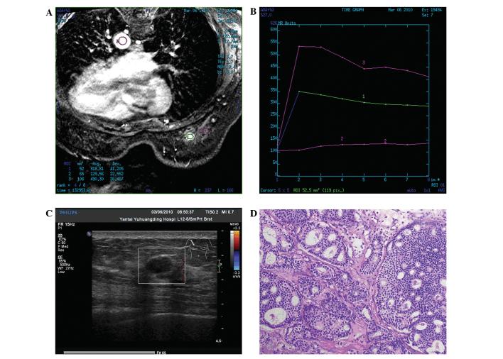 https://cdn.ncbi.nlm.nih.gov/pmc/blobs/2f09/4356388/370707d3a2ed/OL-09-04-1753-g01.jpg