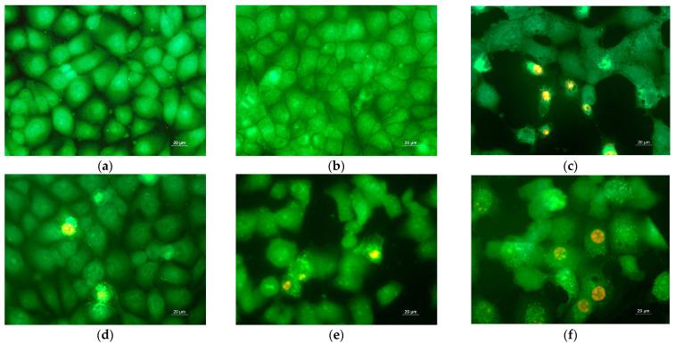 https://cdn.ncbi.nlm.nih.gov/pmc/blobs/2f0e/9783884/6226ea89f99c/polymers-14-05380-g009.jpg