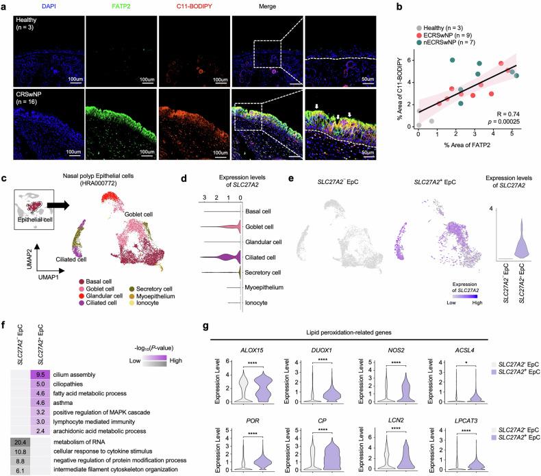 https://cdn.ncbi.nlm.nih.gov/pmc/blobs/2f0f/12045986/575963f4de41/12276_2025_1440_Fig5_HTML.jpg