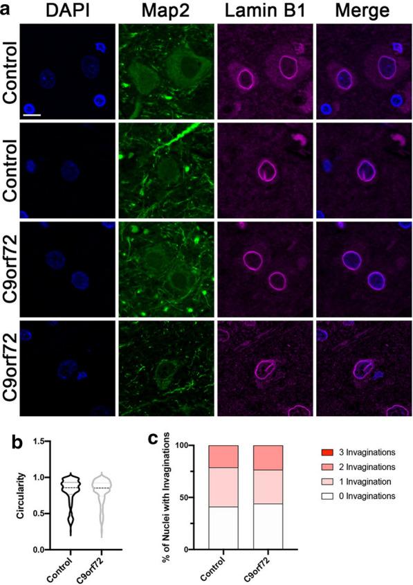 https://cdn.ncbi.nlm.nih.gov/pmc/blobs/2f0f/7977268/697e9845ff77/40478_2021_1150_Fig3_HTML.jpg