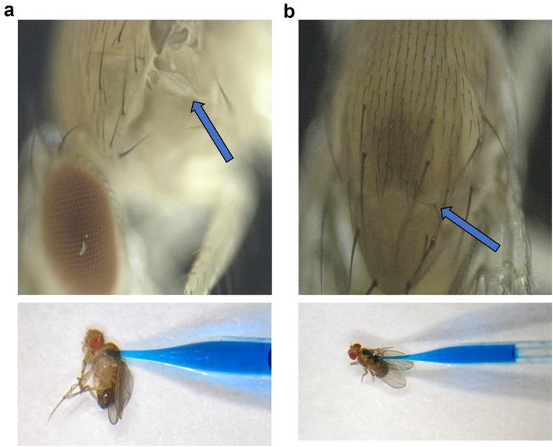 https://cdn.ncbi.nlm.nih.gov/pmc/blobs/2f19/12036485/9c4788cd1ca8/KFLY_A_2497565_F0002_OC.jpg