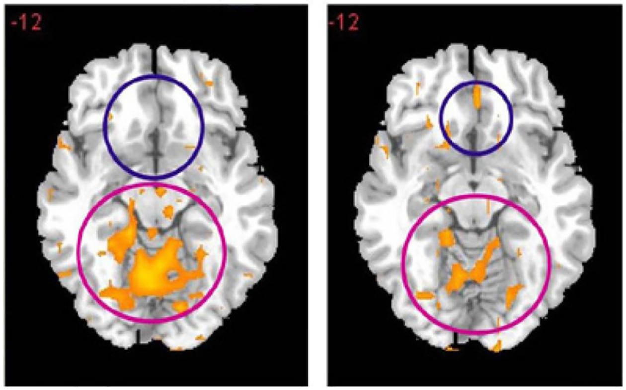 https://cdn.ncbi.nlm.nih.gov/pmc/blobs/2f1a/10758019/1d9855d691a0/nihms-1954734-f0009.jpg