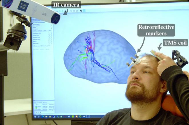 https://cdn.ncbi.nlm.nih.gov/pmc/blobs/2f1e/11685379/8666385c25a4/HBM-46-e70122-g008.jpg