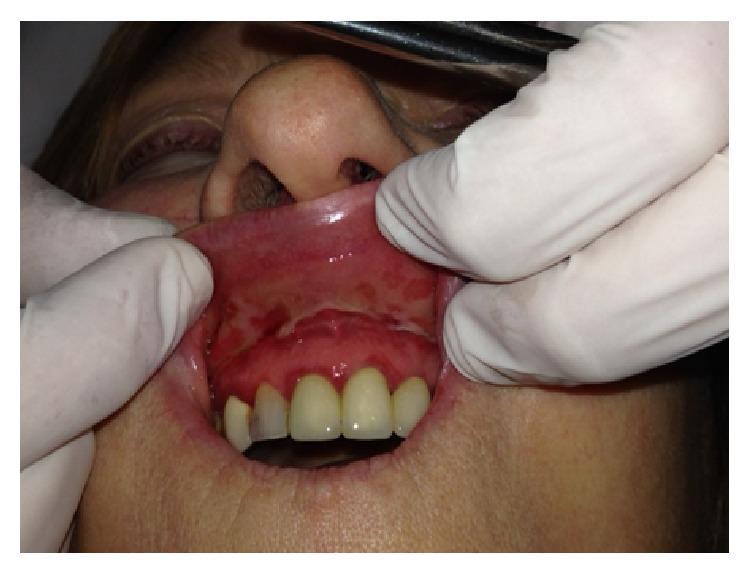 https://cdn.ncbi.nlm.nih.gov/pmc/blobs/2f1e/4391326/9bf951c2bb35/CRID2015-196292.003.jpg