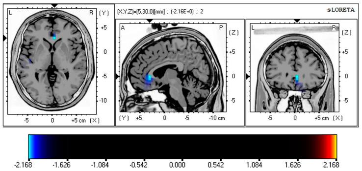 https://cdn.ncbi.nlm.nih.gov/pmc/blobs/2f2d/10605761/8b3f93411801/brainsci-13-01440-g002.jpg