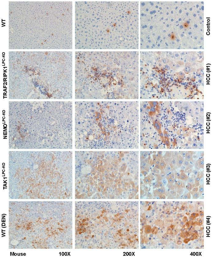 https://cdn.ncbi.nlm.nih.gov/pmc/blobs/2f30/6468921/00472842fdf4/cancers-11-00385-g005.jpg
