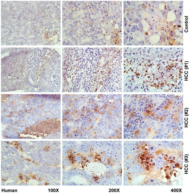 https://cdn.ncbi.nlm.nih.gov/pmc/blobs/2f30/6468921/826bf9749499/cancers-11-00385-g004.jpg