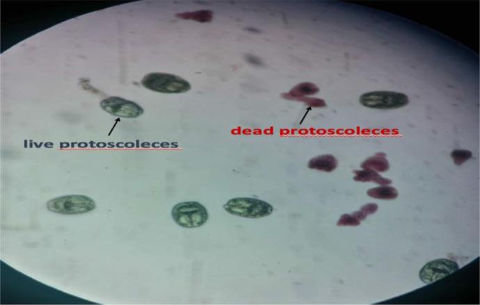 https://cdn.ncbi.nlm.nih.gov/pmc/blobs/2f31/11978201/aa9911699fbf/IJPA-20-83-g003.jpg