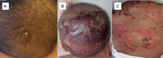 https://cdn.ncbi.nlm.nih.gov/pmc/blobs/2f31/12382381/26dc85ff1699/ActaDV-105-43939-g001.jpg
